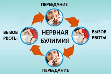Лечение булимии в городе Сергач